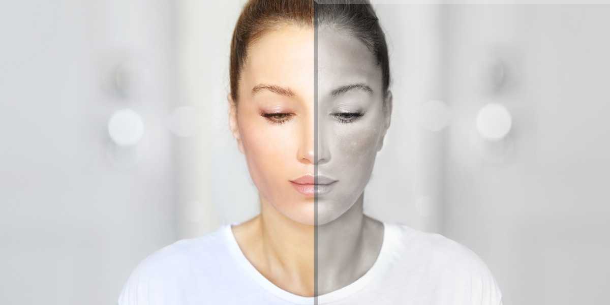 Difference Between Skin Regeneration And Skin Repair