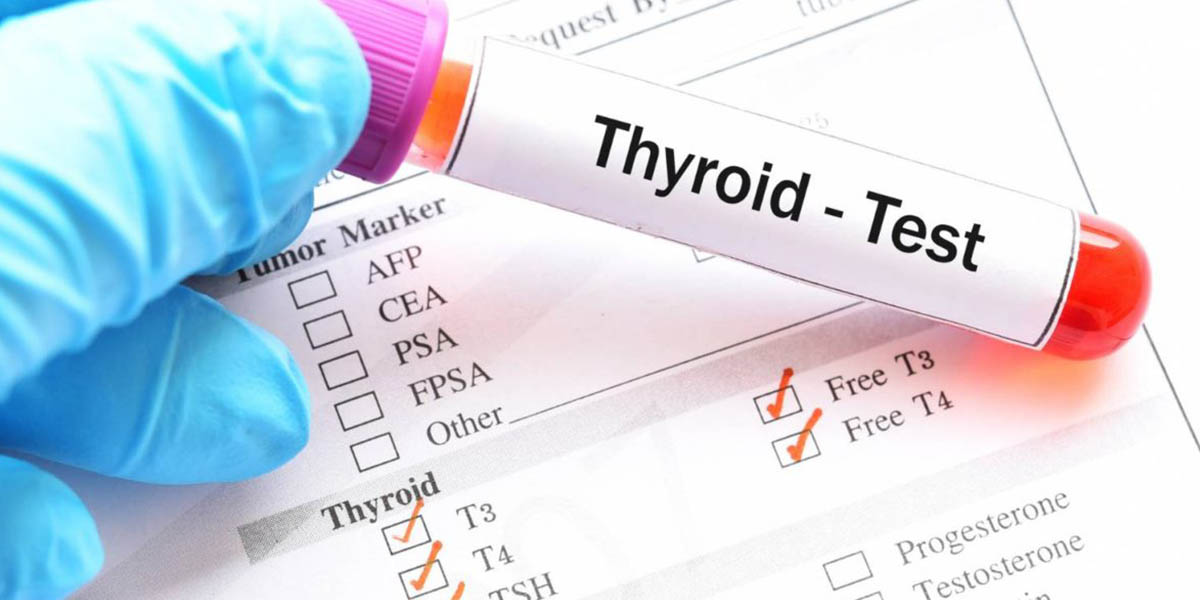 Monitoring Your Thyroid Level