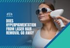 Does Hyperpigmentation From Laser Hair Removal Go Away