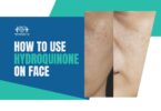 How to Use Hydroquinone on Face